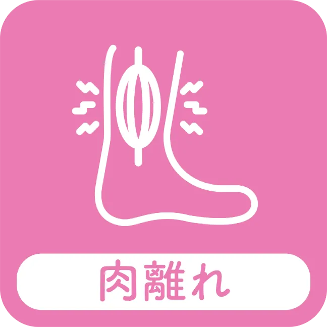 肉離れ